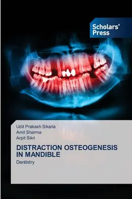 Osteogeneza prin distragere în mandibulă - Distraction Osteogenesis in Mandible
