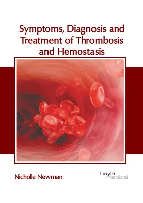 Simptomele, diagnosticul și tratamentul trombozei și hemostazei - Symptoms, Diagnosis and Treatment of Thrombosis and Hemostasis