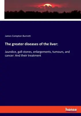 Bolile mai grave ale ficatului: Icterul, calculii biliari, măririle, tumorile și cancerul: Și tratamentul lor - The greater diseases of the liver: Jaundice, gall-stones, enlargements, tumours, and cancer: And their treatment