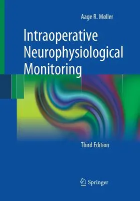 Monitorizarea neurofiziologică intraoperatorie - Intraoperative Neurophysiological Monitoring