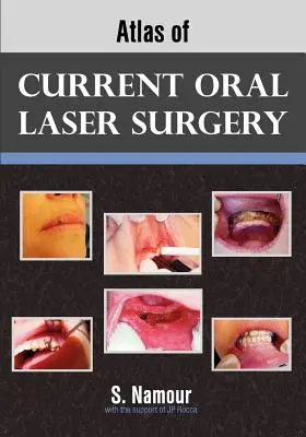 Atlas de chirurgie orală actuală cu laser - Atlas of Current Oral Laser Surgery