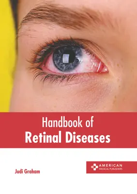 Manual de boli ale retinei - Handbook of Retinal Diseases