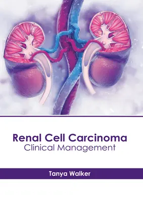 Carcinomul cu celule renale: Management clinic - Renal Cell Carcinoma: Clinical Management