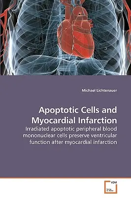 Celulele apoptotice și infarctul miocardic - Apoptotic Cells and Myocardial Infarction