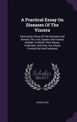 Un eseu practic privind bolile viscerelor: Particularly Those Of The Stomach And Bowels, The Liver, Spleen, And Urinary Bladder: In Which Their Nat - A Practical Essay On Diseases Of The Viscera: Particularly Those Of The Stomach And Bowels, The Liver, Spleen, And Urinary Bladder: In Which Their Nat
