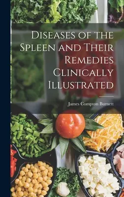 Boli ale splinei și remediile lor ilustrate clinic - Diseases of the Spleen and Their Remedies Clinically Illustrated