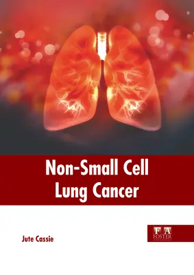 Cancerul pulmonar cu celule ne-smici - Non-Small Cell Lung Cancer