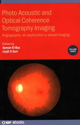 Imagistica prin tomografie cu coerență optică și fotoacustică: Angiografie: - O aplicație în imagistica vaselor - Photo Acoustic and Optical Coherence Tomography Imaging: Angiography: - An Application in Vessel Imaging