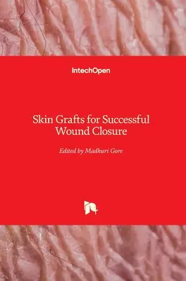 Grefe de piele pentru închiderea cu succes a rănilor - Skin Grafts for Successful Wound Closure