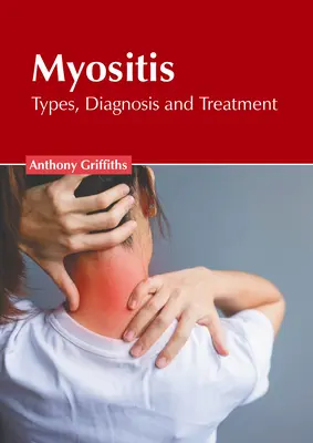 Miosita: Tipuri, diagnostic și tratament - Myositis: Types, Diagnosis and Treatment