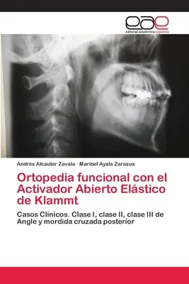 Ortopedia funcțională cu el Activador Abierto Elstico de Klammt - Ortopedia funcional con el Activador Abierto Elstico de Klammt