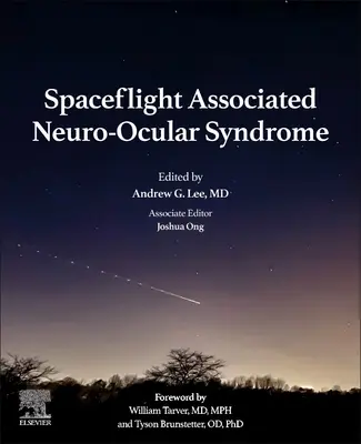 Sindromul neuro-ocular asociat zborului spațial - Spaceflight Associated Neuro-Ocular Syndrome