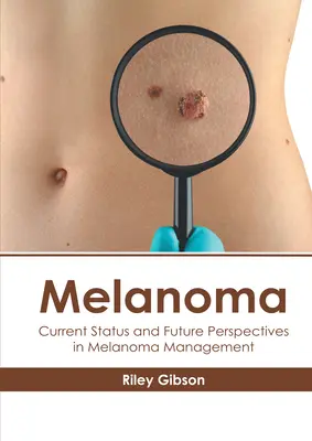 Melanom: Starea actuală și perspectivele viitoare în gestionarea melanomului - Melanoma: Current Status and Future Perspectives in Melanoma Management