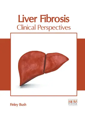 Fibroza hepatică: Perspective clinice - Liver Fibrosis: Clinical Perspectives