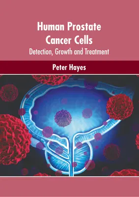 Celule umane de cancer de prostată: Detectare, creștere și tratament - Human Prostate Cancer Cells: Detection, Growth and Treatment