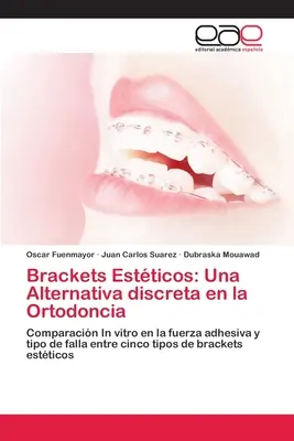 Brackets Estticos: O alternativă discretă la ortodonție - Brackets Estticos: Una Alternativa discreta en la Ortodoncia