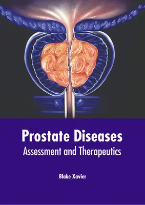 Prostate Diseases: Evaluare și terapeutică - Prostate Diseases: Assessment and Therapeutics