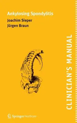 Manualul clinicianului privind spondilita anchilozantă - Clinician's Manual on Ankylosing Spondylitis