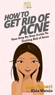Cum să scapi de acnee: Ghidul tău pas cu pas pentru a scăpa de acnee - How To Get Rid of Acne: Your Step By Step Guide To Getting Rid of Acne
