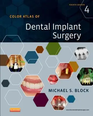 Atlas color al chirurgiei implanturilor dentare - Color Atlas of Dental Implant Surgery