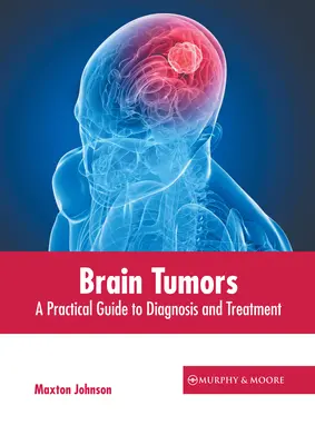 Tumorile cerebrale: Un ghid practic pentru diagnostic și tratament - Brain Tumors: A Practical Guide to Diagnosis and Treatment