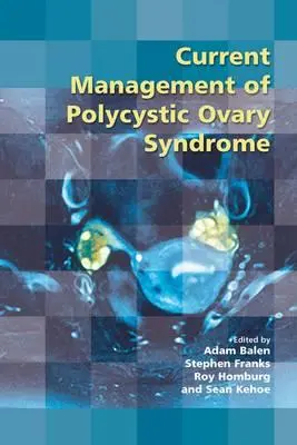 Managementul actual al sindromului ovarului polichistic - Current Management of Polycystic Ovary Syndrome