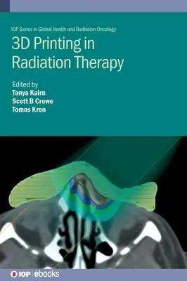 Imprimarea 3D în radioterapie: Hardware personalizat pentru medicina prin radiații - 3D Printing in Radiation Therapy: Personalized Hardware for Radiation Medicine