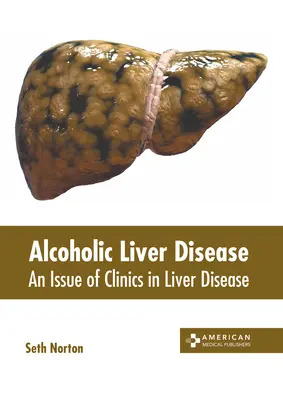 Boala hepatică alcoolică: O ediție a Clinics in Liver Disease - Alcoholic Liver Disease: An Issue of Clinics in Liver Disease