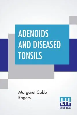 Adenoidele și amigdalele bolnave: Efectul lor asupra inteligenței generale, editat de R. S. Woodworth - Adenoids And Diseased Tonsils: Their Effect On General Intelligence, Edited By R. S. Woodworth