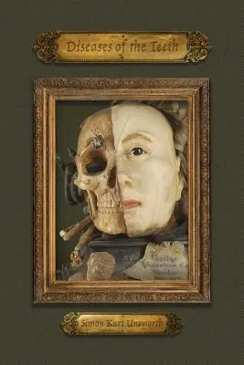 Boli ale dinților - Diseases of the Teeth
