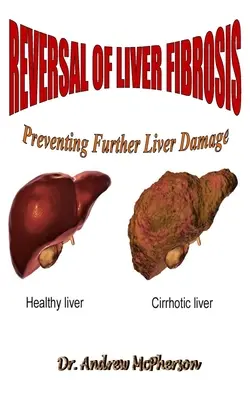Inversarea fibrozei hepatice: Prevenirea deteriorării în continuare a ficatului - Reversal of Liver Fibrosis: Preventing Further Liver Damage