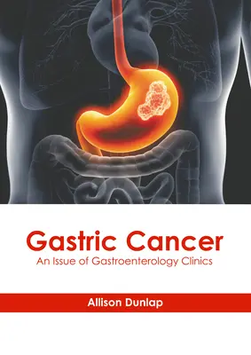 Gastric Cancer: O ediție a Gastroenterology Clinics - Gastric Cancer: An Issue of Gastroenterology Clinics