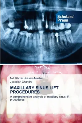 Proceduri de ridicare a sinusurilor maxilare - Maxillary Sinus Lift Procedures