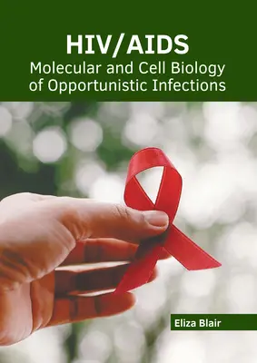 Hiv/Aids: Biologia moleculară și celulară a infecțiilor oportuniste - Hiv/Aids: Molecular and Cell Biology of Opportunistic Infections