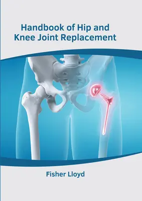 Manual de înlocuire a articulațiilor șoldului și genunchiului - Handbook of Hip and Knee Joint Replacement