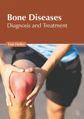 Boli ale oaselor: Diagnostic și tratament - Bone Diseases: Diagnosis and Treatment