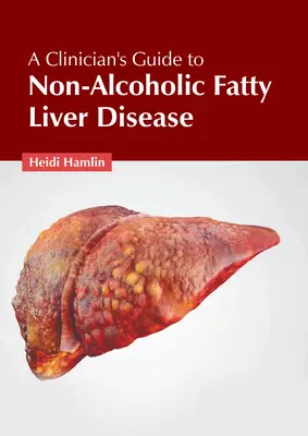 Ghidul clinicianului pentru boala hepatică grasă non-alcoolică (A Clinician's Guide to Non-Alcoholic Fatty Liver Disease) - A Clinician's Guide to Non-Alcoholic Fatty Liver Disease