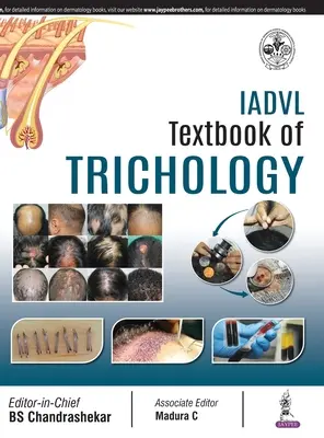 Manual de trichologie al IADVL - IADVL Textbook of Trichology