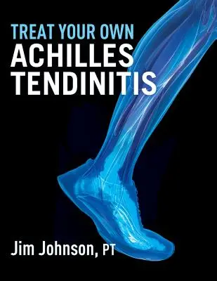 Tratează-ți singur tendinita lui Ahile - Treat Your Own Achilles Tendinitis