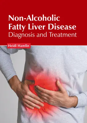 Boala hepatică grasă nonalcoolică: Diagnostic și tratament - Non-Alcoholic Fatty Liver Disease: Diagnosis and Treatment