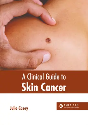 Un ghid clinic pentru cancerul de piele - A Clinical Guide to Skin Cancer