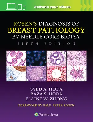 Rosen's Diagnosis of Breast Pathology by Needle Core Biopsy (Diagnosticul lui Rosen al patologiei sânului prin biopsie cu ac central) - Rosen's Diagnosis of Breast Pathology by Needle Core Biopsy
