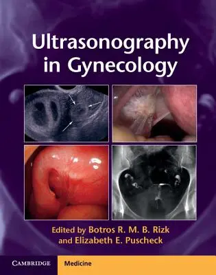 Ultrasonografia în ginecologie - Ultrasonography in Gynecology