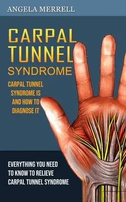 Sindromul tunelului carpian: Sindromul tunelului carpian este și cum să îl diagnostichezi - Carpal Tunnel Syndrome: Carpal Tunnel Syndrome is and How to Diagnose It
