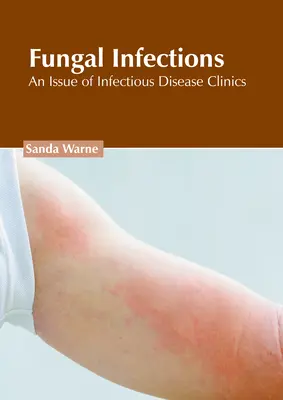 Infecții fungice: O ediție a Infectious Disease Clinics - Fungal Infections: An Issue of Infectious Disease Clinics