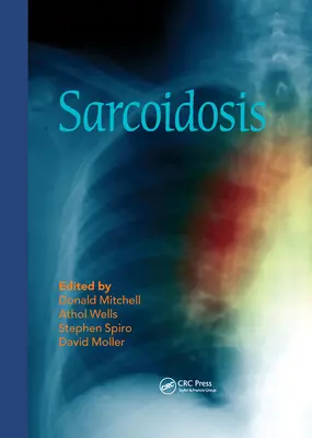 Sarcoidoza - Sarcoidosis