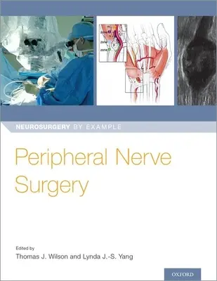 Chirurgia nervului periferic - Peripheral Nerve Surgery