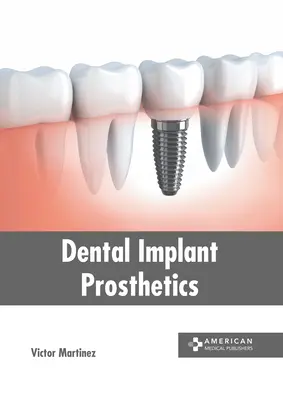 Implant dentar protetic - Dental Implant Prosthetics