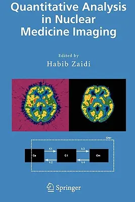 Analiza cantitativă în imagistica de medicină nucleară - Quantitative Analysis in Nuclear Medicine Imaging