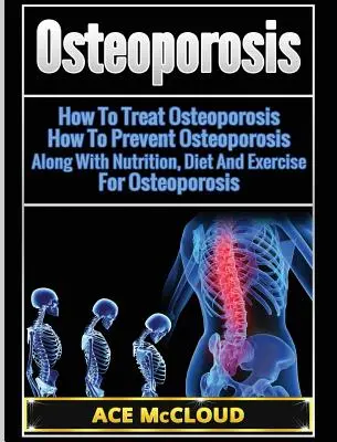 Osteoporoza: Cum Să Tratăm Osteoporoza: Cum Să Prevenim Osteoporoza: Împreună cu Nutriția, Dieta și Exercițiul Pentru Osteoporoză - Osteoporosis: How To Treat Osteoporosis: How To Prevent Osteoporosis: Along With Nutrition, Diet And Exercise For Osteoporosis